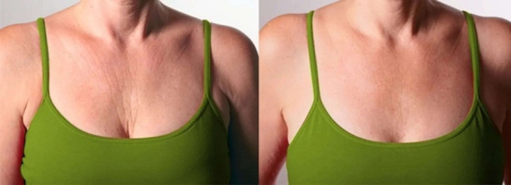 кожа на груди у женщин фото 17
