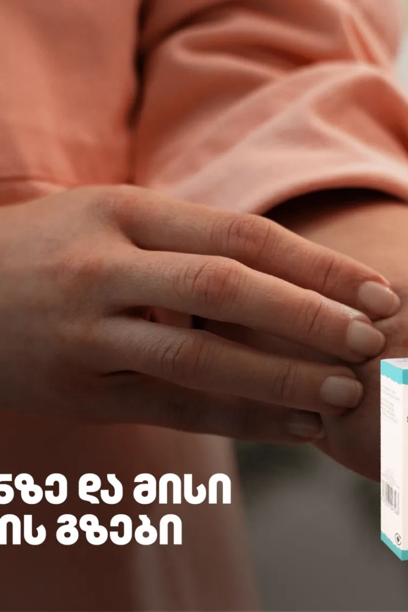 ალერგია კანზე და მისი
მკურნალობის გზები