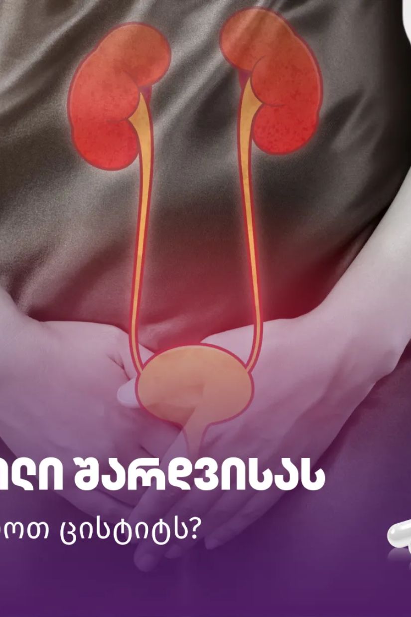 წვა და ტკივილი შარდვისას -
როგორ ვუმკურნალოთ
ცისტიტს?