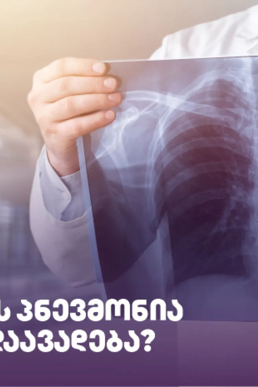 პნევმონია