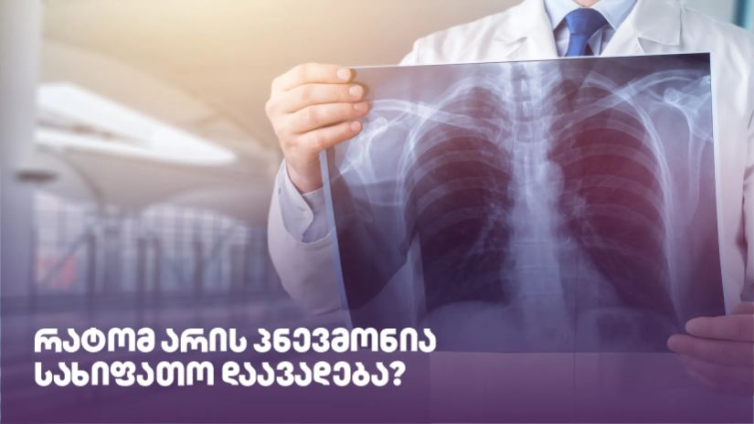 პნევმონია