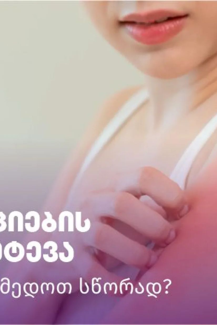 ჭინჭრის ციების უეცარი
შეტევა – როგორ ვიმოქმედოთ
სწორად?