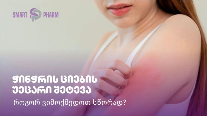 ჭინჭრის ციების უეცარი
შეტევა – როგორ ვიმოქმედოთ
სწორად?