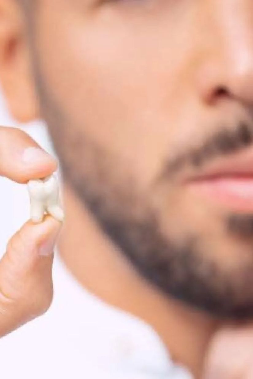 სიბრძნის კბილი და
ღეროვანი უჯრედები